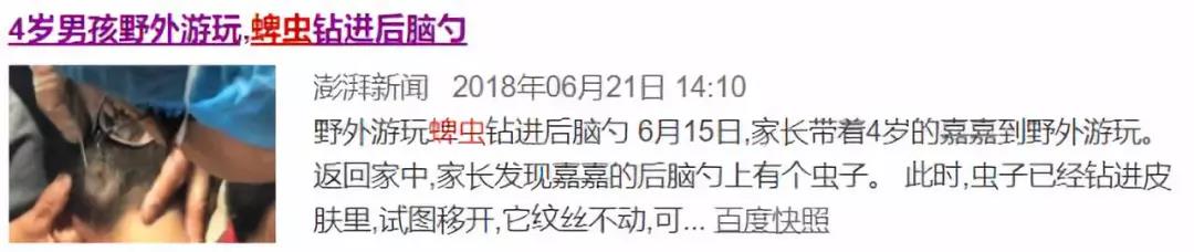 夏季「蜱虫病」进入高发期,紧急处理赶紧get 夏季「蜱虫病」进入高发期,紧急处理赶紧get